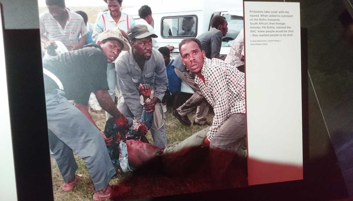Image of injured protester in South Africa during apartheid
